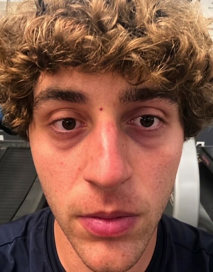 Before — tired and dull